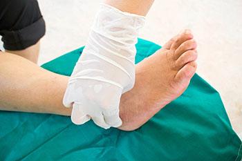 Diabetic Ulcers Treatment in the Southbury & Farmington, CT areas