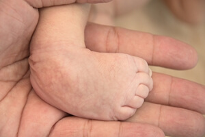 Two Categories of Clubfoot