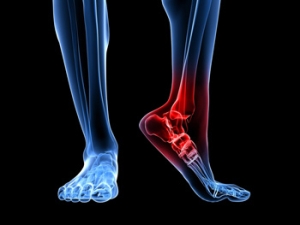 Heel Pain 101