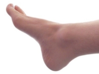 Possible Causes of Tarsal Tunnel Syndrome